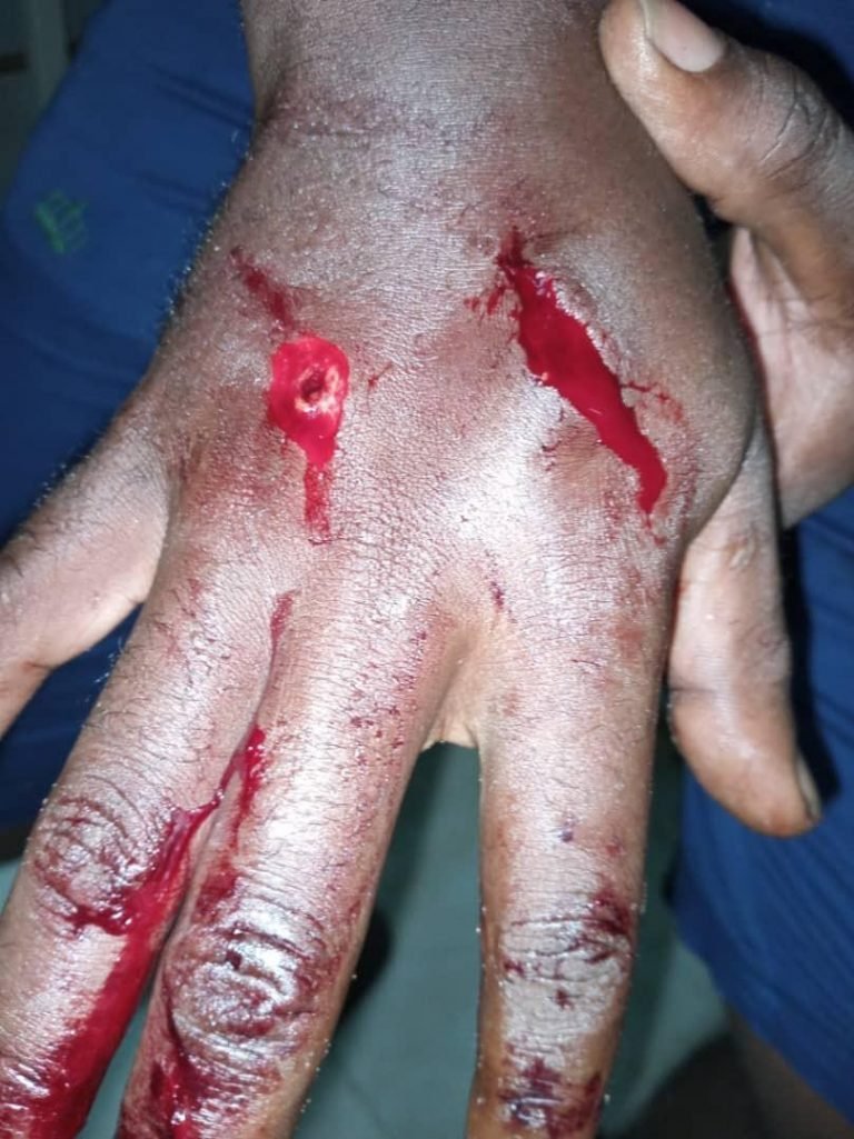 CLIQUE LEADER STABS 3 POLICE OFFICERS